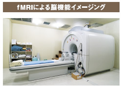 fMRIによる脳機能イメージング